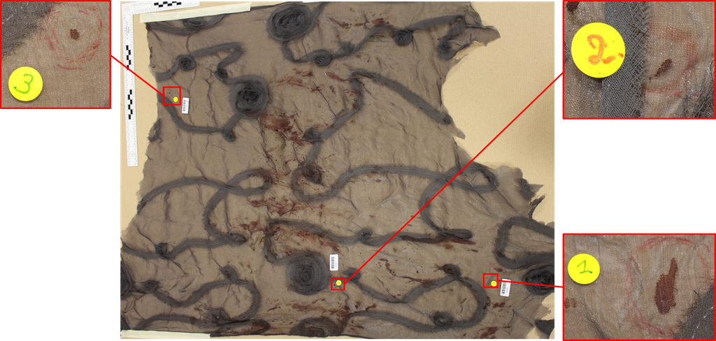 Morphoanalyse de traces de sang utilisée en police scientifique
